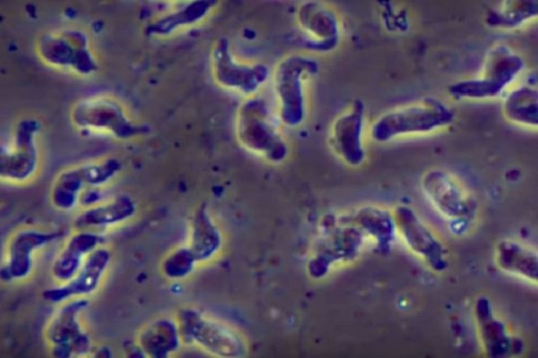 Parents Credit God for Curing Their Son from Rare Brain-Eating Amoeba