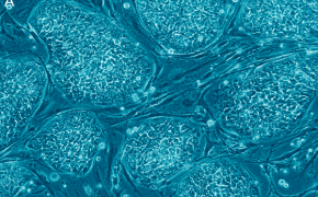Hebrew University Researchers Create Embryonic Stem Cells without an a Egg or Sperm