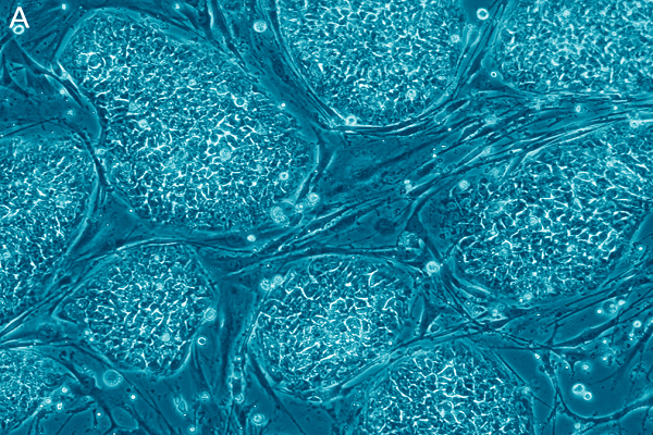 Hebrew University Researchers Create Embryonic Stem Cells without an a Egg or Sperm