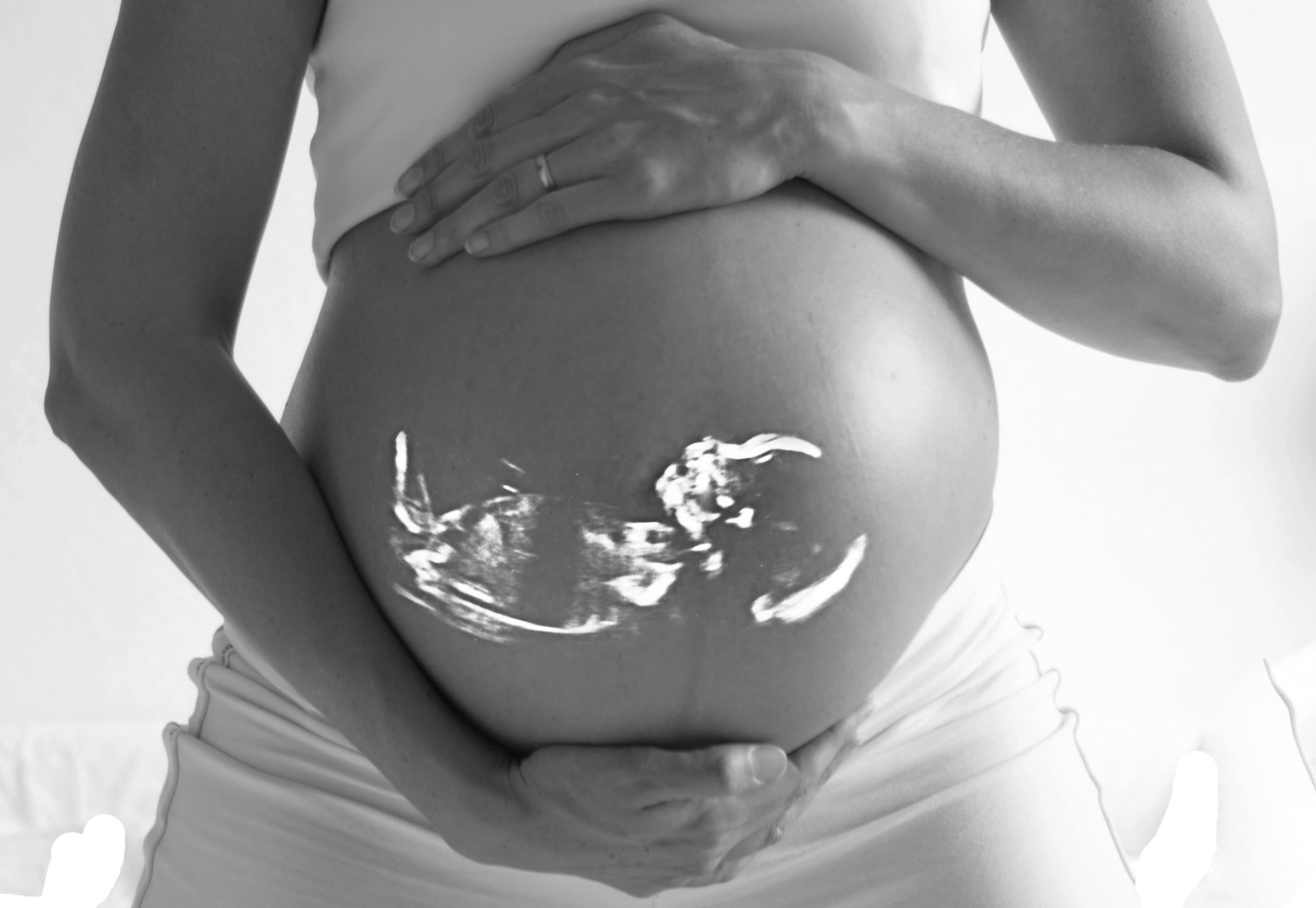 So When Does Life Begin?